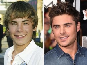 zac efron prima e dopo