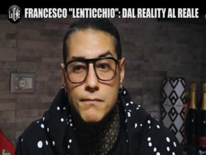 Francesco Temptation Island dopo operazione