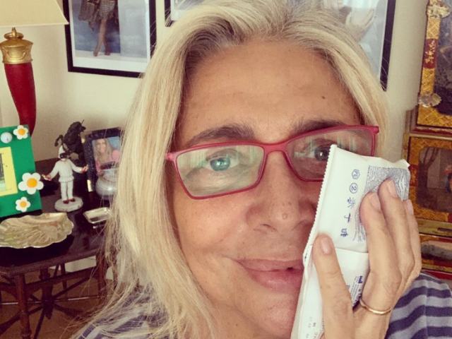 Mara Venier con il ghiaccio sul viso dopo l'intervento: cosa è successo