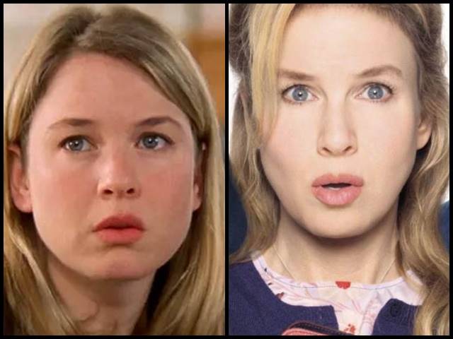 Renée Zellweger chirurgia estetica