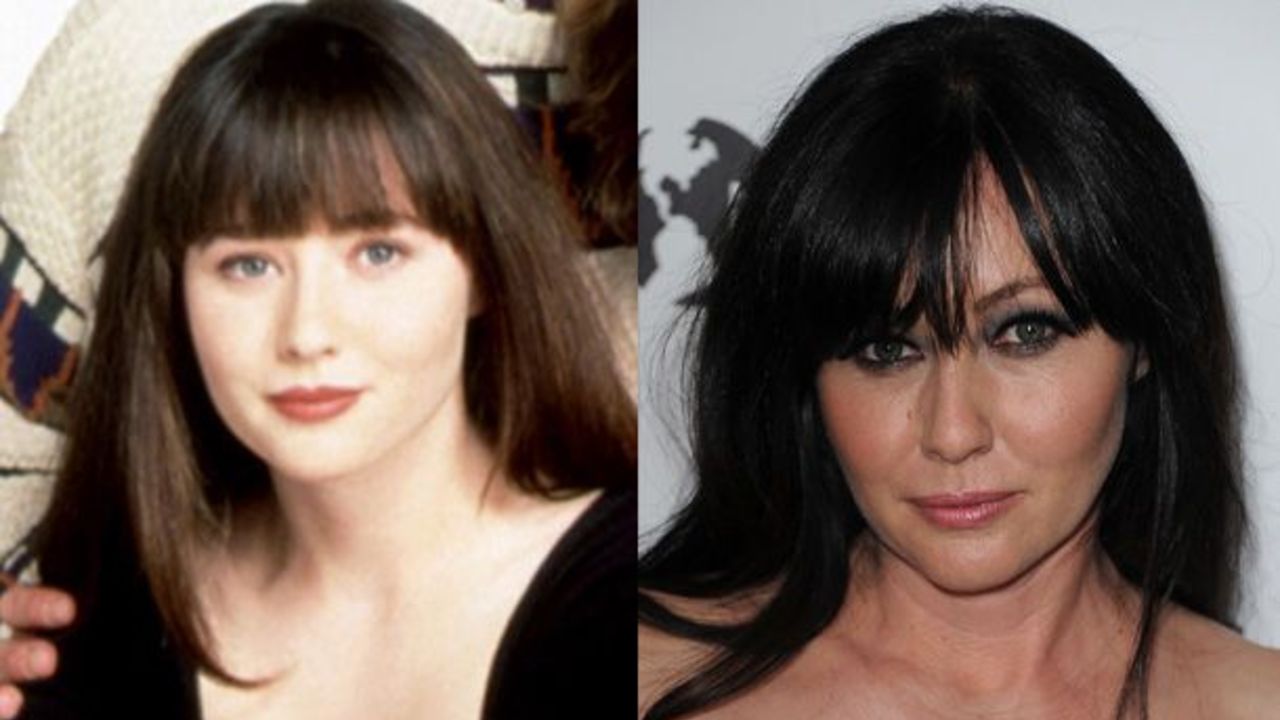 shannen doherty prima e dopo