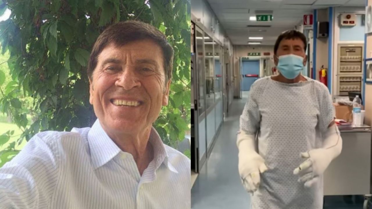 gianni morandi dopo le ustioni