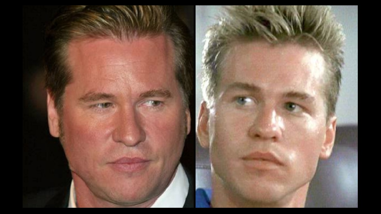 Val Kilmer cancro