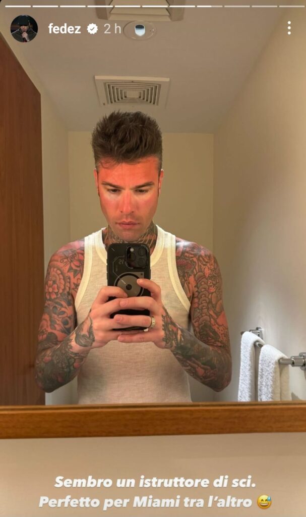 Fedez si ustiona a Miami