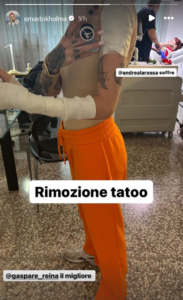 ema stokholma tatuaggi rimozione