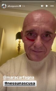 Alfono Signorini Video Instagram 