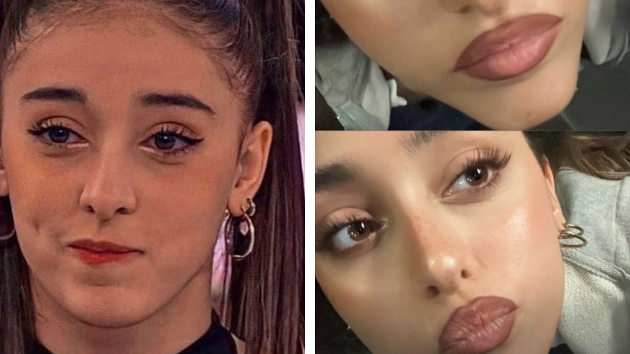 Giulia Stabile Rifatta Labbra