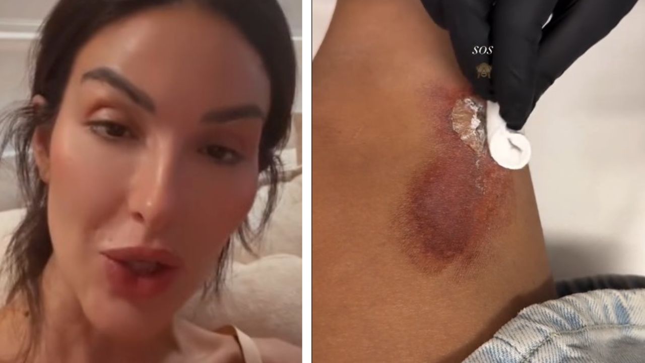 Rosa Perrotta Infortunata Come Sta Adesso