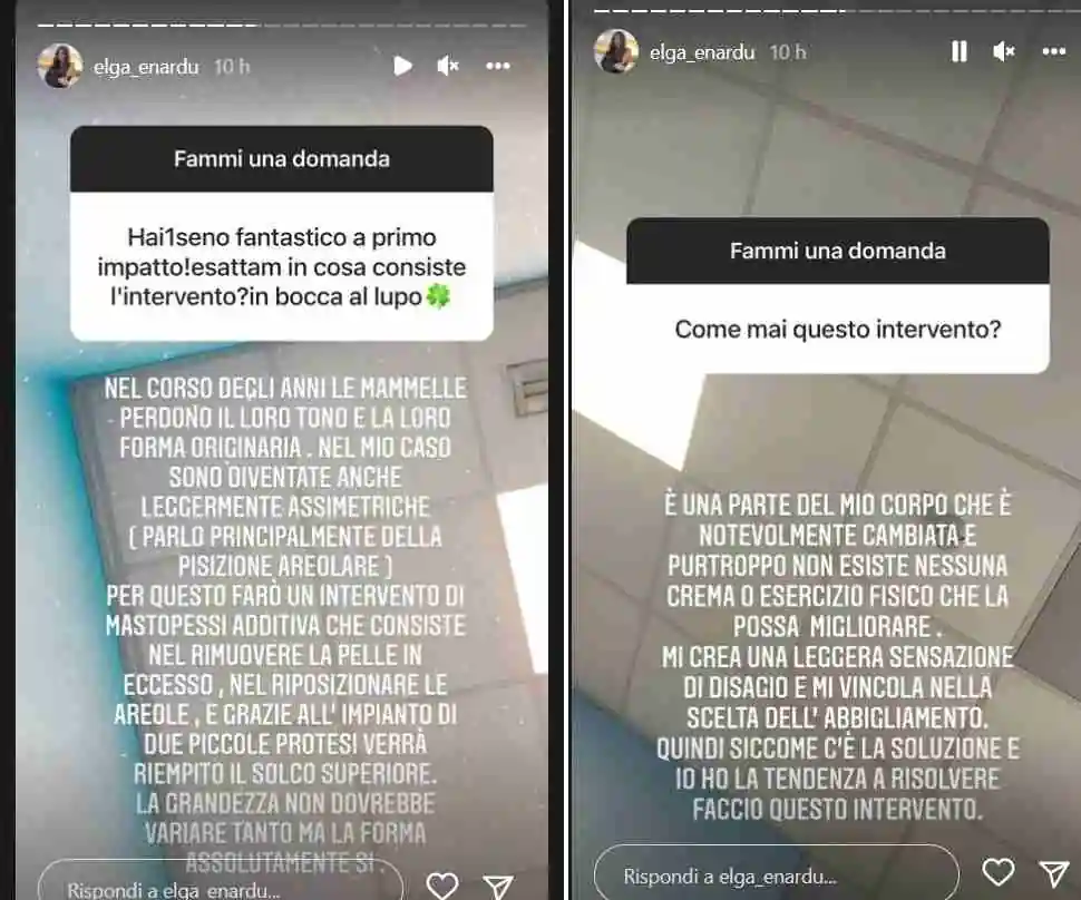 Elga Enardu e il lifting al seno