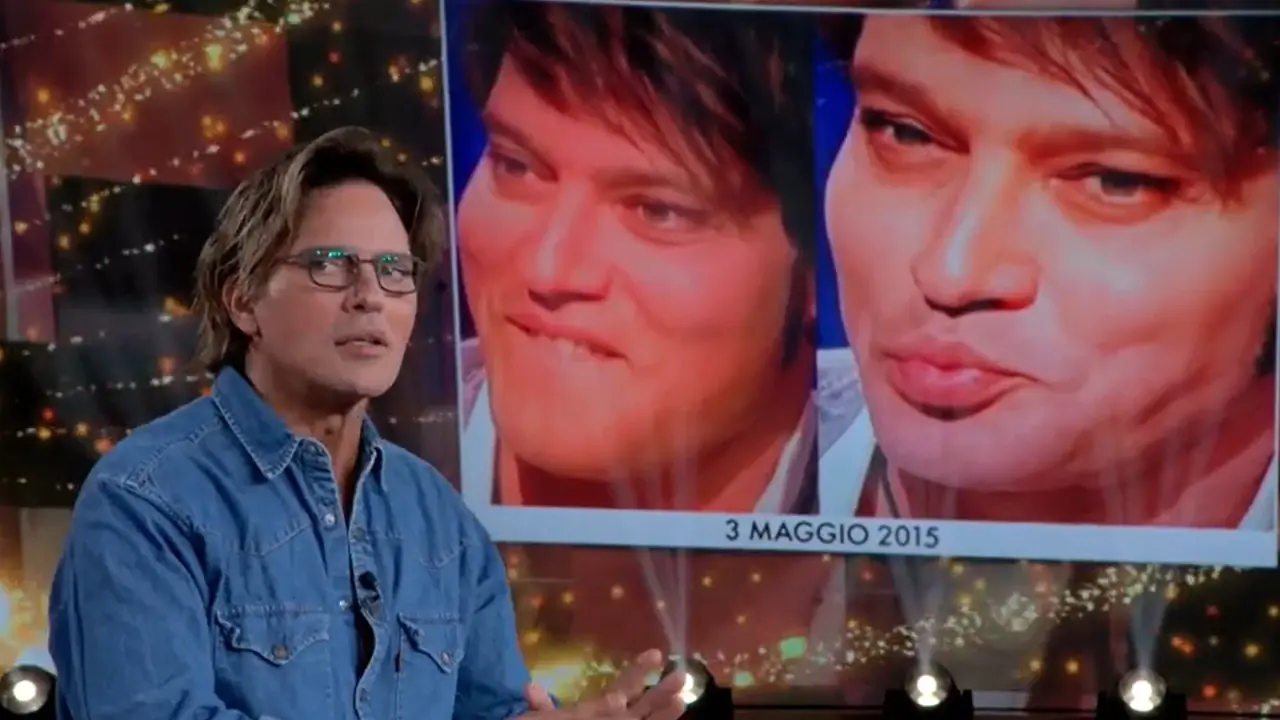 Gabriel Garko e i ritocchini